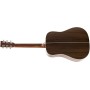 MARTIN D-28 1933 Ambertone